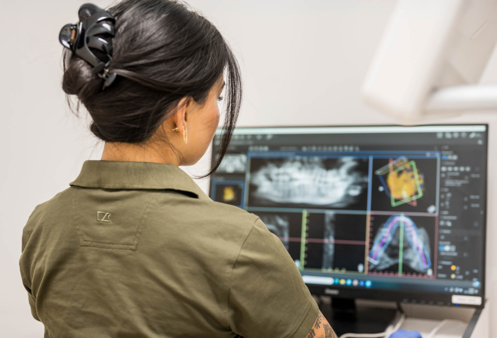 Bekijken CBCT tandarts