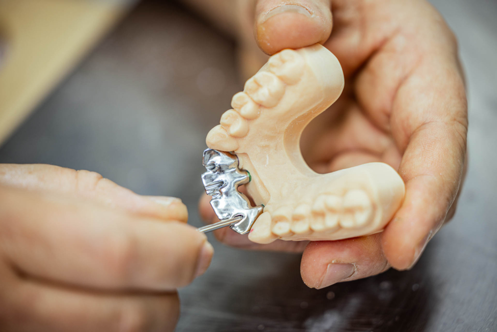 Vastschroeven implantaat